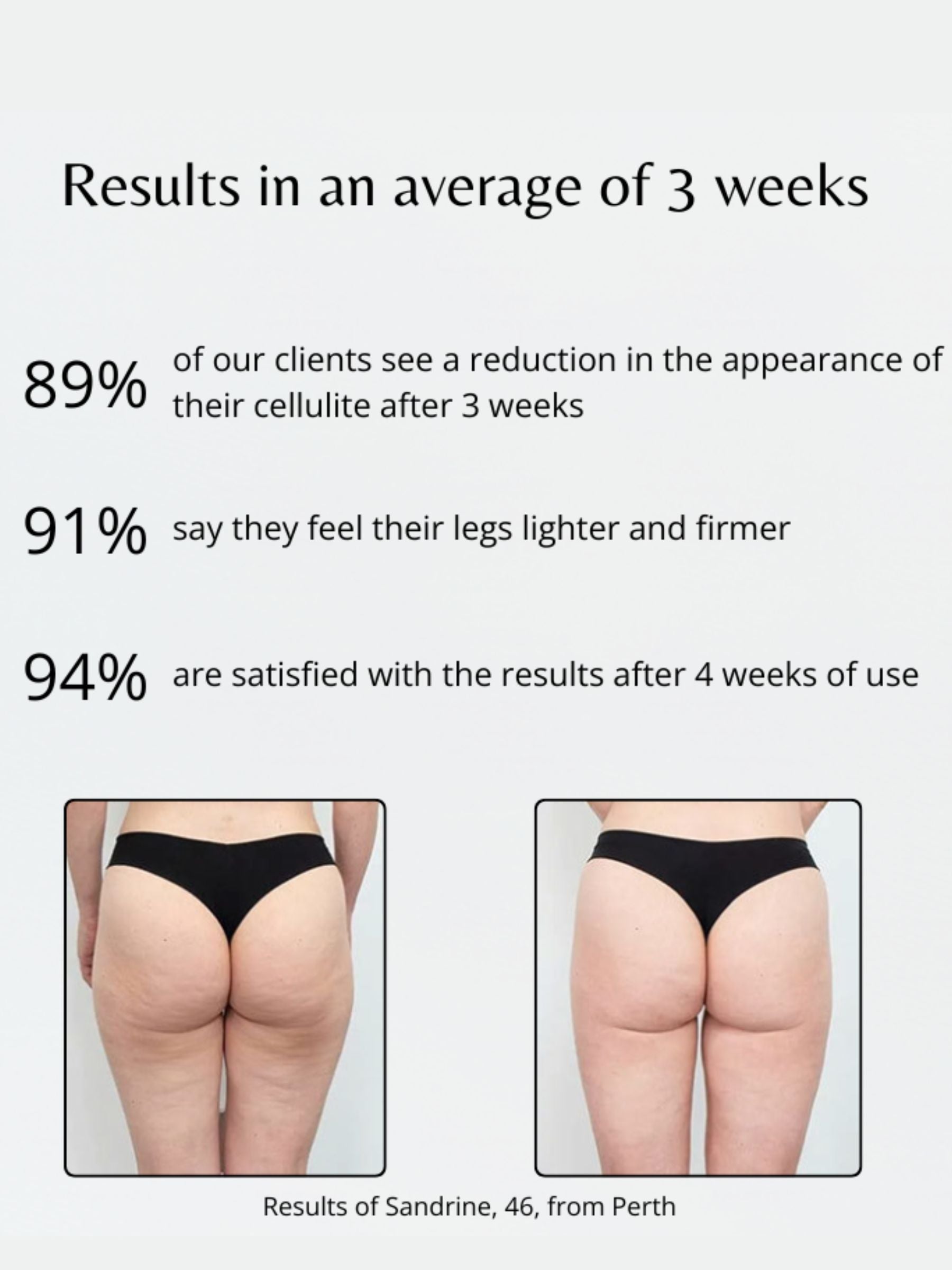 3D Anti-Cellulite Legging